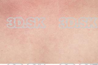 Skin of nude Ross 0001